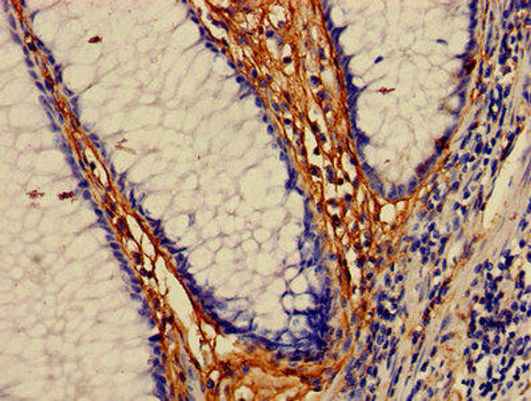 MAP3K7 Antibody (PACO28150)