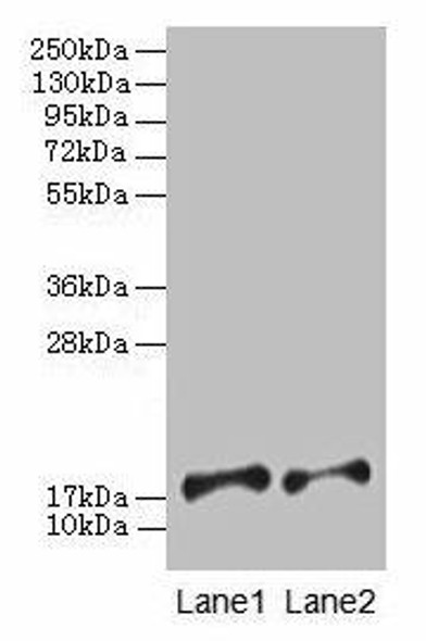 PFDN5 Antibody (PACO28266)
