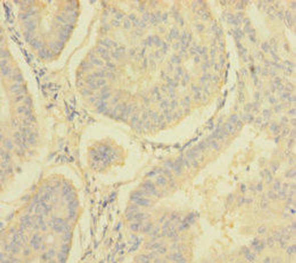 NDUFA6 Antibody (PACO28522)