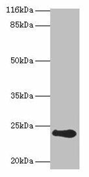 RCVRN Antibody (PACO29432)