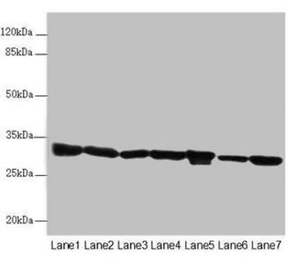 ECHS1 Antibody (PACO45595)