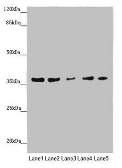 MTHFD2 Antibody (PACO45605)
