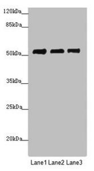 PRPF4 Antibody (PACO45614)