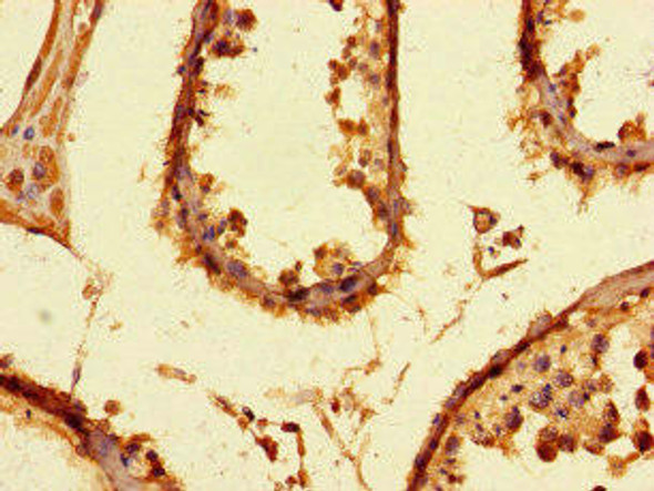 PRMT6 Antibody (PACO47006)