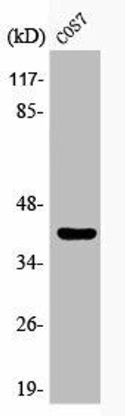 Phospho-GATA1 (S310) Antibody (PACO00214)