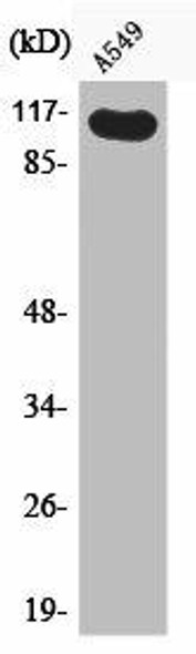 Phospho-HGS (Y216) Antibody (PACO00216)