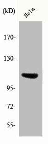 Phospho-ITGB3 (Y785) Antibody (PACO00286)