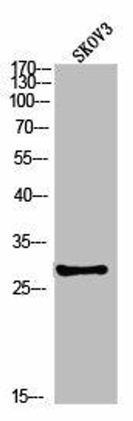 Phospho-PPP2CA (Y307) Antibody (PACO02992)