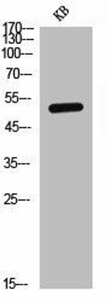 IL7R Antibody (PACO06898)