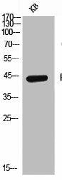 PVR Antibody (PACO06912)