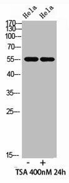 Acetyl-HNF4A (Lys106) Antibody (PACO07330)