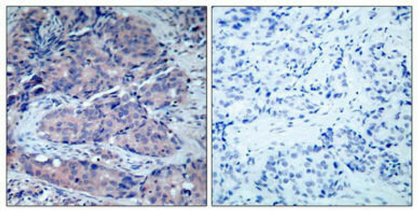 MAP2K4 (Ab-261) Antibody (PACO22915)