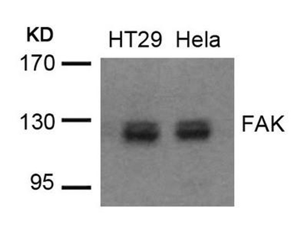PTK2 (Ab-576/577) Antibody (PACO23017)
