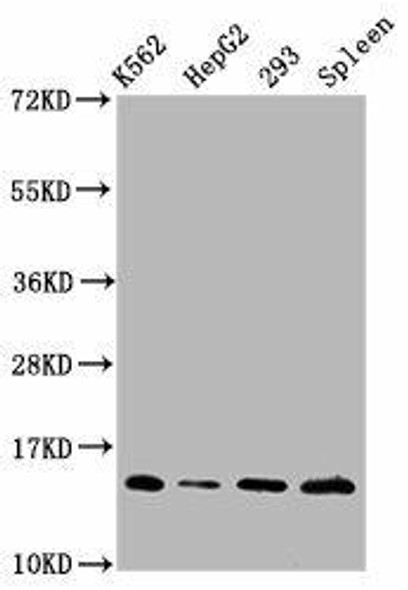 HIST1H2BC (Ab-108) Antibody (PACO59656)