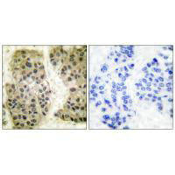 MCM3AP Antibody (PACO23662)