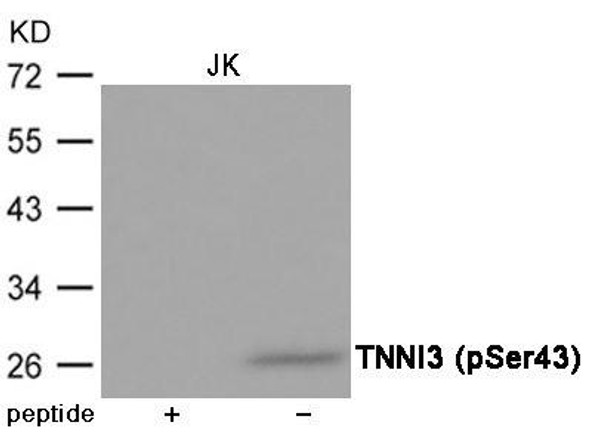 Phospho-TNNI3 (Ser43) Antibody (PACO23957)