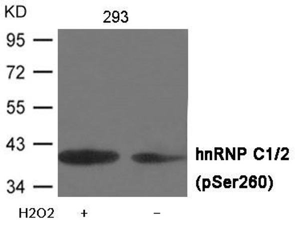 Phospho-HNRNPC (Ser260) Antibody (PACO23965)