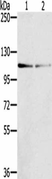 DSTYK Antibody (PACO16990)