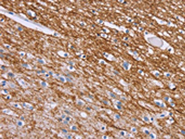 CRH Antibody (PACO17732)