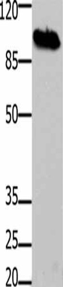 DNM1 Antibody (PACO17803)