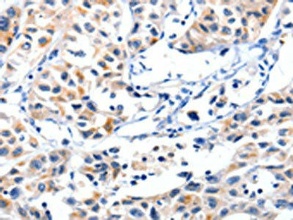 FBLN5 Antibody (PACO17864)