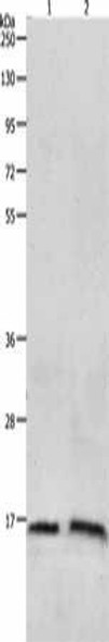 LHB Antibody (PACO18150)