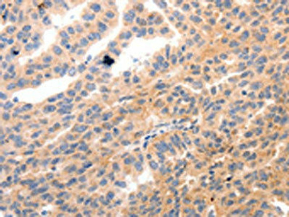MYL9 Antibody (PACO18257)