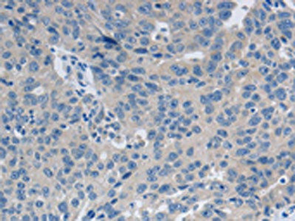 GRIN1 Antibody (PACO18301)