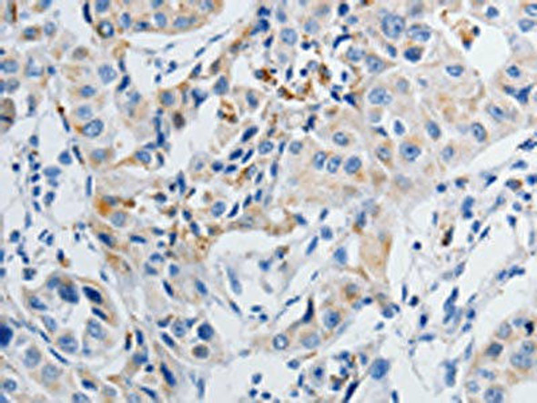 GRIA3 Antibody (PACO18314)
