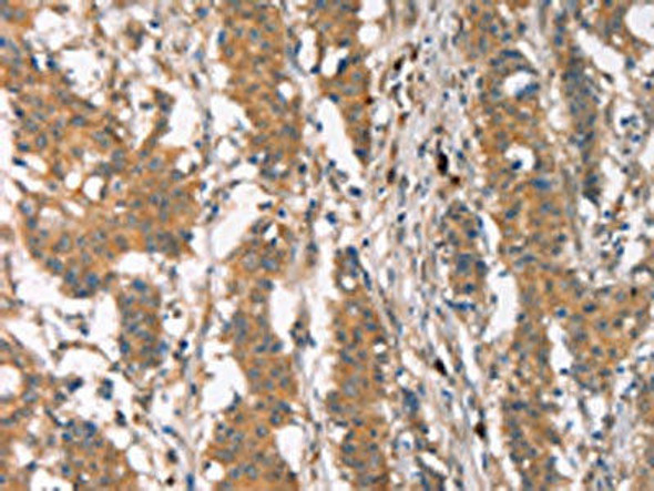 PLIN2 Antibody (PACO19312)