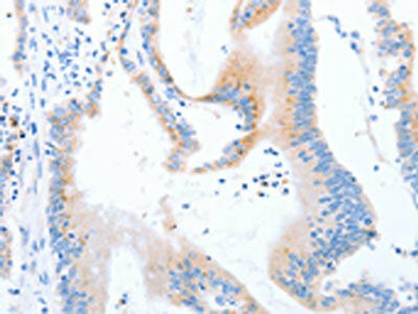 STK4 Antibody (PACO19395)