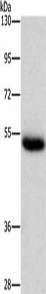 CTSC Antibody (PACO19398)