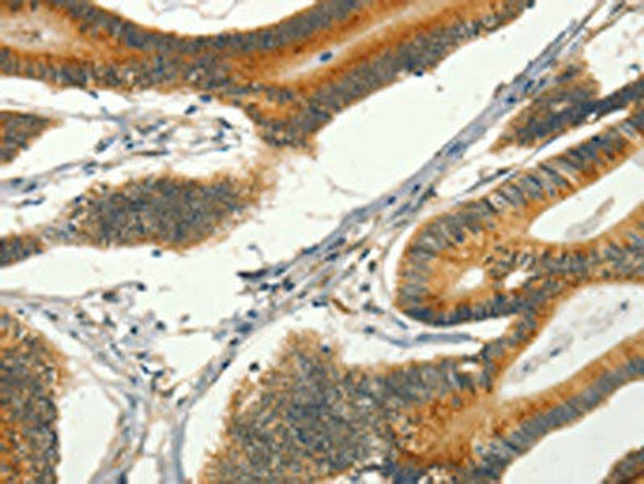 CIB1 Antibody (PACO19473)