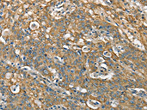 CSMD1 Antibody (PACO19521)