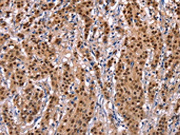 EFNA5 Antibody (PACO19606)