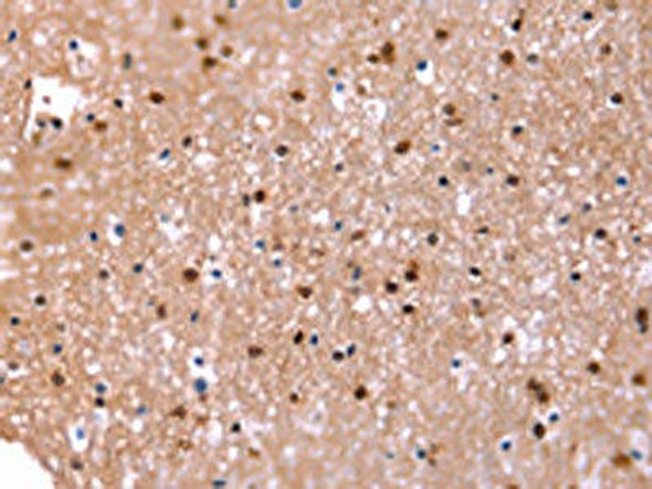 FAT1 Antibody (PACO19648)