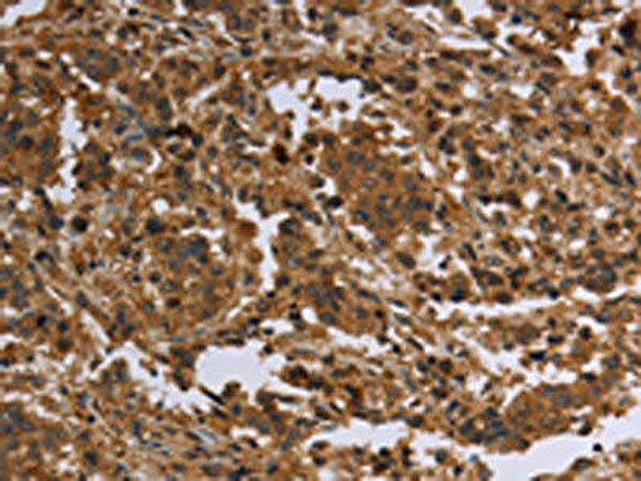 FLG Antibody (PACO19663)