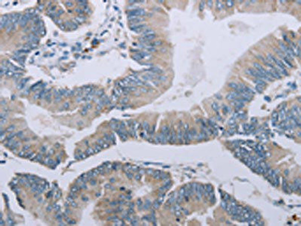 MRGPRX1 Antibody (PACO20038)