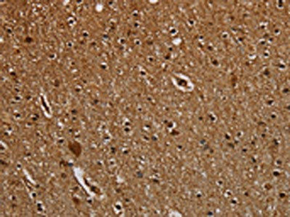 DCAF6 Antibody (PACO20131)