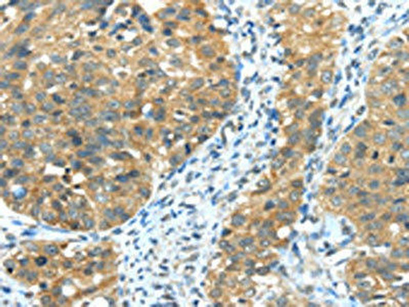 TRIB1 Antibody (PACO20761)