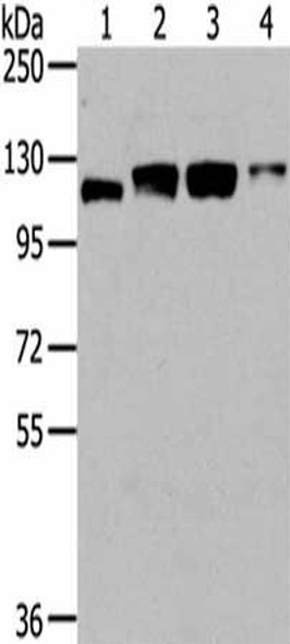 UBA1 Antibody (PACO20806)