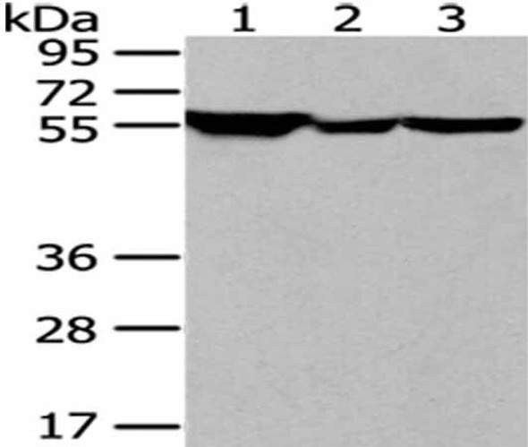 FYN Antibody (PACO20892)