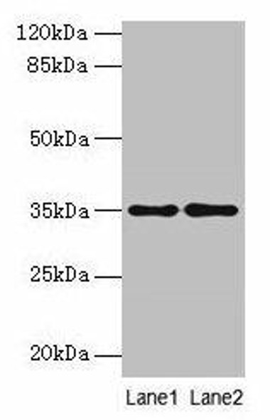 SDSL Antibody (PACO29796)