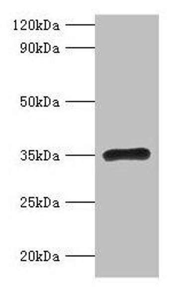 RPL5 Antibody (PACO30826)