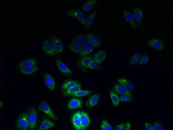 TSPAN7 Antibody (PACO30858)