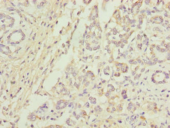 ANAPC5 Antibody (PACO31908)