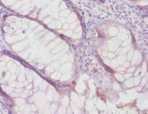 TIMP4 Antibody (PACO32384)