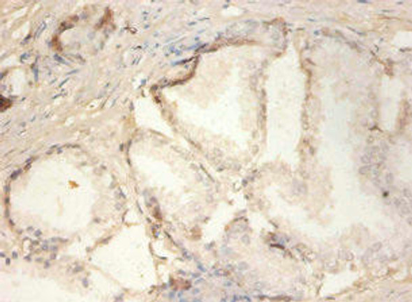 PLA2G2A Antibody (PACO32972)
