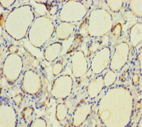 TPO Antibody (PACO33204)