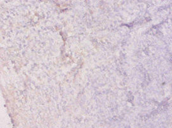 HPRT1 Antibody (PACO33644)